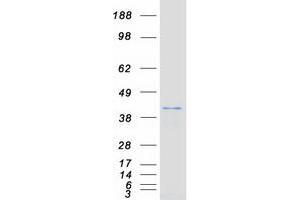 Western Blotting (WB) image for Dual Specificity Phosphatase 4 (DUSP4) (Transcript Variant 2) protein (Myc-DYKDDDDK Tag) (ABIN2719838)
