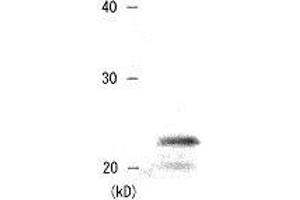 Western Blotting (WB) image for anti-Chromobox Homolog 5 (CBX5) (AA 179-191) antibody (ABIN2452033) (CBX5 抗体  (AA 179-191))