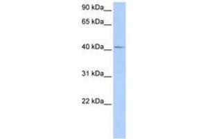 Image no. 1 for anti-General Transcription Factor IIH, Polypeptide 4, 52kDa (GTF2H4) (AA 72-121) antibody (ABIN6742235) (GTF2H4 抗体  (AA 72-121))