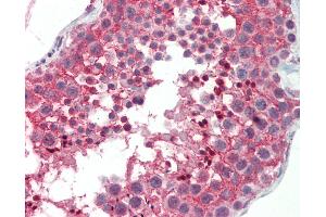 Anti-CNOT3 antibody IHC staining of human testis. (CNOT3 抗体  (AA 141-190))