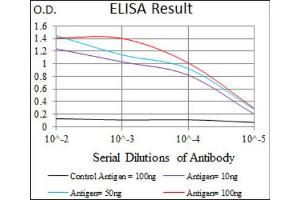 Immunohistochemical analysis of paraffin-embedded esophageal cancer tissues using CD59 antibody with DAB staining. (CD59 抗体  (AA 31-111))