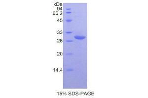 SDS-PAGE (SDS) image for Complement Decay-Accelerating Factor (CD55) (AA 47-286) protein (His tag) (ABIN1878215)