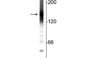 Western blot of rat cortical lysate showing specific immunolabeling of the ~160 kDa adenylate cyclase III protein. (ADCY3 抗体  (C-Term))