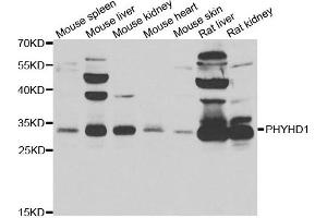Western blot analysis of extracts of various cell lines, using PHYHD1 antibody. (PHYHD1 抗体)
