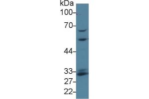 Detection of GCLM in Human K562 cell lysate using Polyclonal Antibody to Glutamate Cysteine Ligase, Modifier Subunit (GCLM) (GCLM 抗体  (AA 40-251))