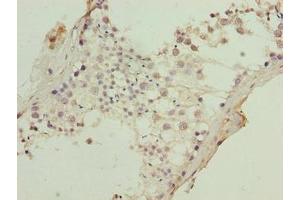 Immunohistochemistry of paraffin-embedded human testis tissue using ABIN7157468 at dilution of 1:100 (KRT8 抗体  (AA 1-300))