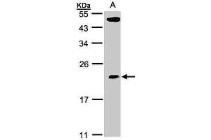 WB Image Sample(30 ug whole cell lysate) A:293T 12% SDS PAGE antibody diluted at 1:500 (TPRKB 抗体)
