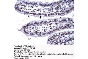 Human Intestine (MYF6 抗体  (N-Term))