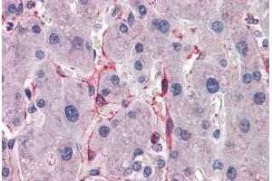 Human Liver: Formalin-Fixed, Paraffin-Embedded (FFPE) (SIAH1 抗体  (AA 191-240))