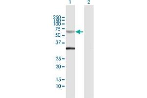 Western Blot analysis of SMAD6 expression in transfected 293T cell line by SMAD6 MaxPab polyclonal antibody. (SMAD6 抗体  (AA 1-496))