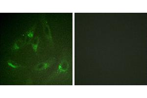 Peptide - +Immunohistochemistry analysis of paraffin-embedded human brain tissue using CSFR (Ab-561) antibody. (CSF1R 抗体)