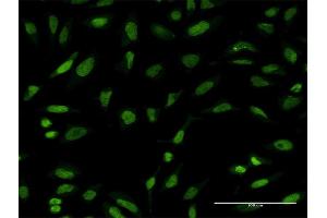 Immunofluorescence of monoclonal antibody to PTTG1 on HeLa cell. (PTTG1 抗体  (AA 93-113))