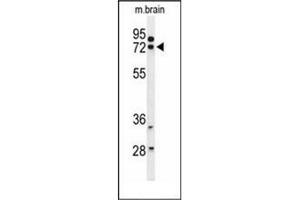 Western blot analysis of HSPA12A Antibody (Center) in mouse brain tissue lysates (35ug/lane). (HSPA12A 抗体  (Middle Region))