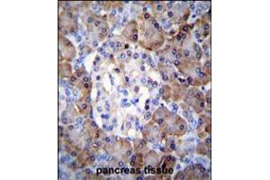 TIMP1 Antibody immunohistochemistry analysis in formalin fixed and paraffin embedded human pancreas tissue followed by peroxidase conjugation of the secondary antibody and DAB staining. (TIMP1 抗体  (C-Term))