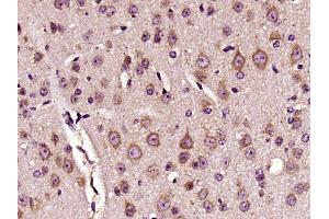 Paraformaldehyde-fixed, paraffin embedded mouse brain, Antigen retrieval by boiling in sodium citrate buffer (pH6) for 15min, Block endogenous peroxidase by 3% hydrogen peroxide for 30 minutes,  Blocking buffer (normal goat serum) at 37°C for 20min, Antibody incubation with DKK3 Polyclonal Antibody (bs-2688R) at 1:400 overnight at 4°C, followed by a conjugated secondary and DAB staining. (DKK3 抗体  (AA 31-130))