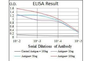 Black line: Control Antigen (100 ng), Purple line: Antigen(10 ng), Blue line: Antigen (50 ng), Red line: Antigen (100 ng), (CRP 抗体)