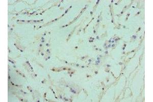Immunohistochemistry of paraffin-embedded human prostate tissue using ABIN7144586 at dilution of 1:100 (ARG2 抗体  (AA 1-354))