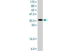 Western Blot detection against Immunogen (37. (ASMT 抗体  (AA 71-170))