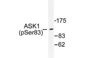 Image no. 1 for anti-Mitogen-Activated Protein Kinase Kinase Kinase 5 (MAP3K5) (pSer83) antibody (ABIN317961) (ASK1 抗体  (pSer83))
