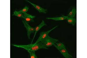 IF analysis of TSEN34 and Tubulin beta using anti-TSEN34 antibody (ABIN7599254) and anti-Tubulin beta antibody (ABIN7602744). (TSEN34 抗体  (AA 1-310))
