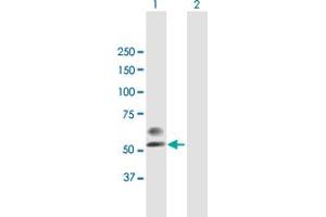 Western Blot analysis of PLA2G3 expression in transfected 293T cell line by PLA2G3 MaxPab polyclonal antibody. (PLA2G3 抗体  (AA 1-509))