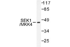 Image no. 1 for anti-Mitogen-Activated Protein Kinase Kinase 4 (MAP2K4) antibody (ABIN271811) (MAP2K4 抗体)