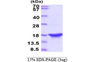 SDS-PAGE (SDS) image for Synuclein, beta (SNCB) protein (ABIN666819) (beta Synuclein 蛋白)