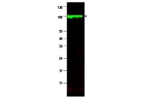 Western blot using  affinity purified anti-iASPP antibody shows detection of a band at ~100 kDa (arrowhead) corresponding to isoform 1 of iASPP in MCF7 whole cell lysates. (PPP1R13L 抗体  (Isoform 1))