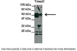 Lanes:   Lane 1 and 2: 30 ug HEK-293 cell lysate  Primary Antibody Dilution:   1:1000  Secondary Antibody:   Anti-Rabbit HRP  Secondary Antibody Dilution:   1:2000  Gene Name:   Tmed1  Submitted by:   Anonymous (TMED1 抗体  (N-Term))