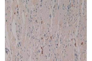 Detection of LEAP2 in Human Rectum Tissue using Polyclonal Antibody to Liver Expressed Antimicrobial Peptide 2 (LEAP2) (LEAP2 抗体  (AA 23-76))