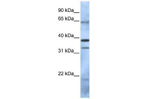 PCGF5 antibody used at 1 ug/ml to detect target protein. (PCGF5 抗体  (N-Term))