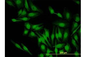 Image no. 2 for anti-PDZ Binding Kinase (PBK) (AA 1-110) antibody (ABIN599275) (PBK 抗体  (AA 1-110))