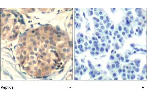 Image no. 1 for anti-Mast/stem Cell Growth Factor Receptor (KIT) (AA 934-938) antibody (ABIN401646) (KIT 抗体  (AA 934-938))