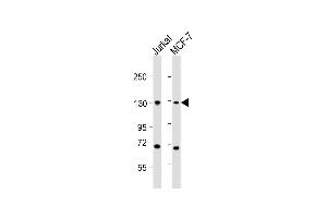 All lanes : Anti-CTCF Antibody (Center) at 1:2000 dilution Lane 1: Jurkat whole cell lysates Lane 2: MCF-7 whole cell lysates Lysates/proteins at 20 μg per lane. (CTCF 抗体  (AA 334-364))