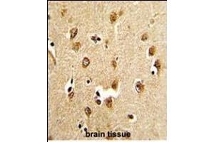 Immunohistochemistry (Paraffin-embedded Sections) (IHC (p)) image for anti-Abl-Interactor 1 (ABI1) (AA 81-108), (N-Term) antibody (ABIN652475)