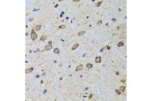 Immunohistochemistry (Paraffin-embedded Sections) (IHC (p)) image for anti-Cyclin-Dependent Kinase 1 (CDK1) (AA 208-258) antibody (ABIN3020707)