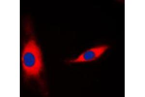Immunofluorescent analysis of Mammaglobin B staining in HepG2 cells. (SCGB2A1 抗体  (N-Term))