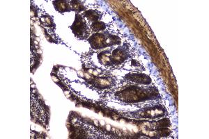 IHC analysis of POLR2A using anti-POLR2A antibody . (POLR2A/RPB1 抗体  (AA 1148-1384))