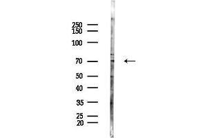 anti-Homeodomain Interacting Protein Kinase 4 (HIPK4) (C-Term) antibody