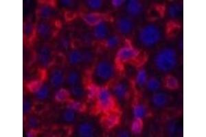 Immunofluorescence analysis of Mouse liver tissue using ACTA1 Monoclonal Antibody at dilution of 1:200. (Actin 抗体)