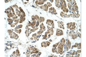 RHOT1 antibody was used for immunohistochemistry at a concentration of 4-8 ug/ml. (RHOT1 抗体  (N-Term))