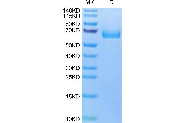 PLAUR Protein (AA 23-305) (His tag)
