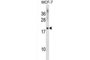 Western Blotting (WB) image for anti-CKLF-Like MARVEL Transmembrane Domain Containing 5 (CMTM5) antibody (ABIN2999517) (CMTM5 抗体)