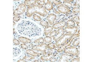 IHC analysis of HDAC11 using anti-HDAC11 antibody (ABIN3043840). (HDAC11 抗体  (N-Term))