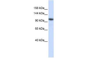 B4GALNT3 antibody used at 1 ug/ml to detect target protein. (B4GALNT3 抗体  (N-Term))