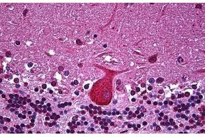 Human Brain, Cerebellum: Formalin-Fixed, Paraffin-Embedded (FFPE) (TNF alpha 抗体  (AA 1-234))
