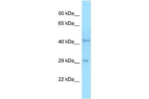 WB Suggested Anti-B4galt3 Antibody   Titration: 1. (B4GALT3 抗体  (C-Term))
