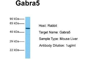Host: Rabbit Target Name: Gabra5 Sample Tissue: Mouse Liver Antibody Dilution: 1. (GABRA5 抗体  (Middle Region))