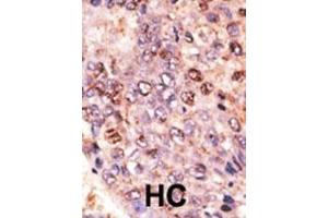 Immunohistochemistry (Paraffin-embedded Sections) (IHC (p)) image for anti-ATP-Binding Cassette, Sub-Family B (MDR/TAP), Member 7 (ABCB7) (AA 718-746), (C-Term) antibody (ABIN390062)