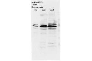 Image no. 2 for anti-Heterogeneous Nuclear Ribonucleoprotein L (HNRNPL) antibody (ABIN108588) (HNRNPL 抗体)